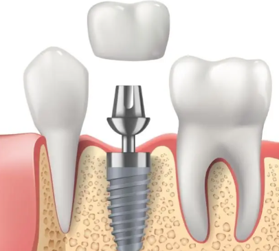 缓解疼痛不适的方法