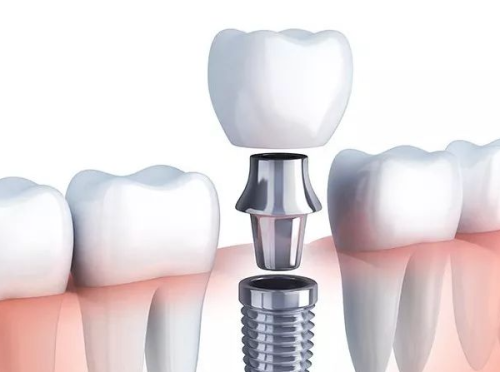 护理情况对维持时间的影响