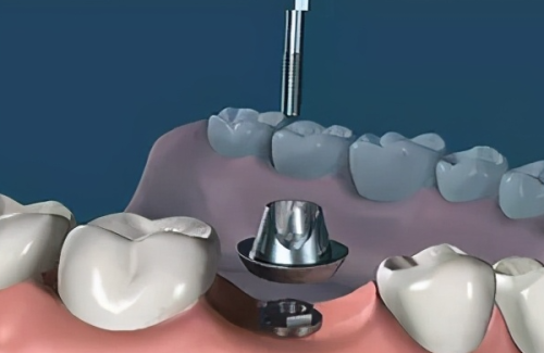 制定种植计划：个性化方案定制