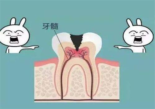 根管治疗的特点与注意事项