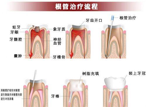 牙齿本身状况和医生技术的重要性