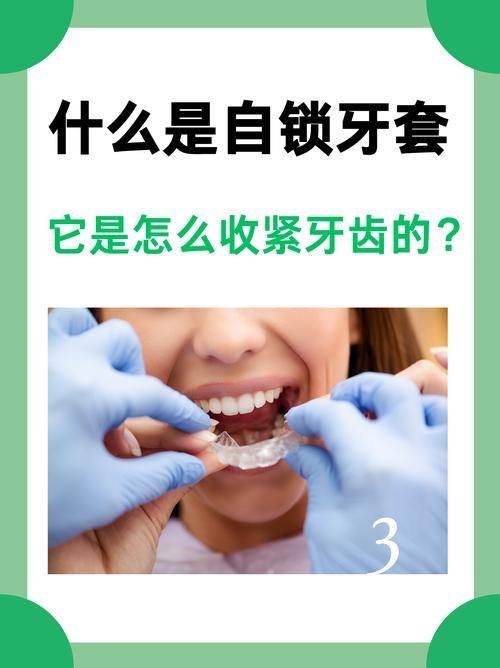 牙齿矫正费用的其他支付方式
