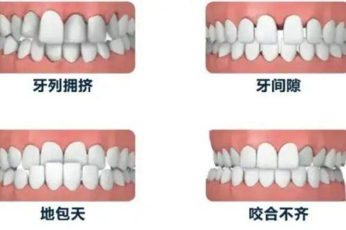 骨性需手术情况的矫正年龄