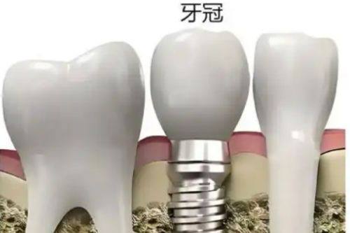 术前充分沟通与检查