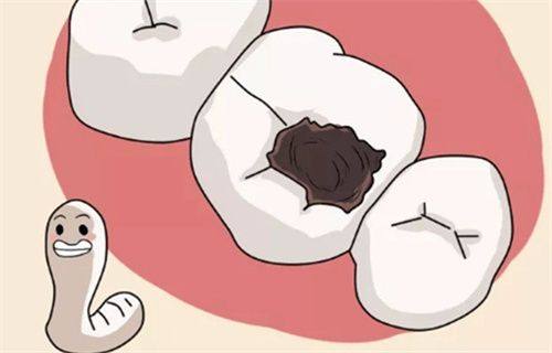 预防补牙后内部继续烂的建议