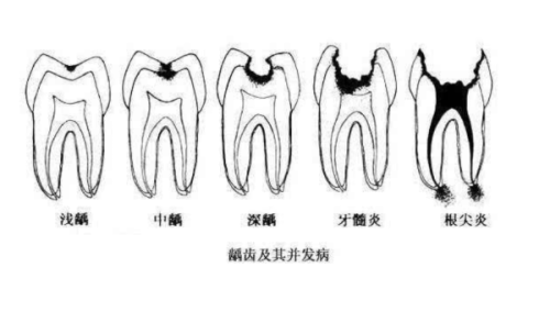 病因机制:相同的致病根源