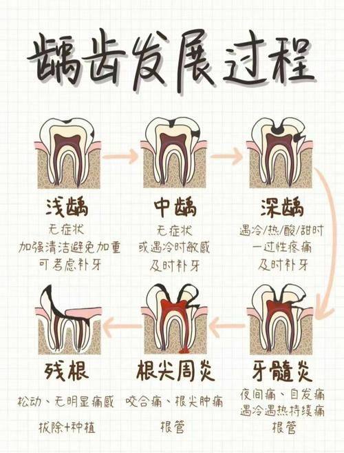 饮食控制：减少糖分摄入