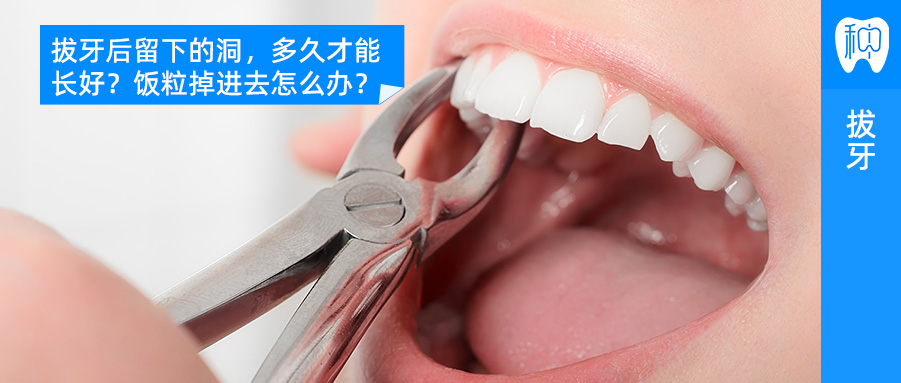 拔牙后留下的洞，多久才能长好？饭粒掉进去怎么办？