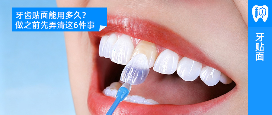 牙齿贴面能用多久?做之前先弄清这6件事